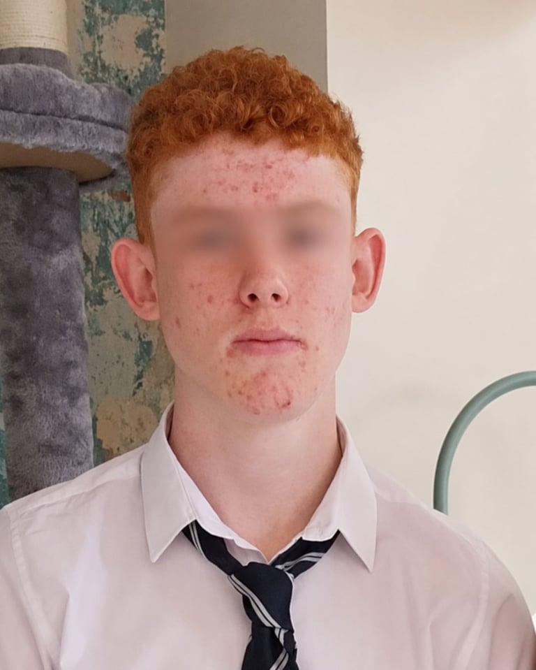 Before treatment - portrait with reddish-brown curly hair and pale complexion