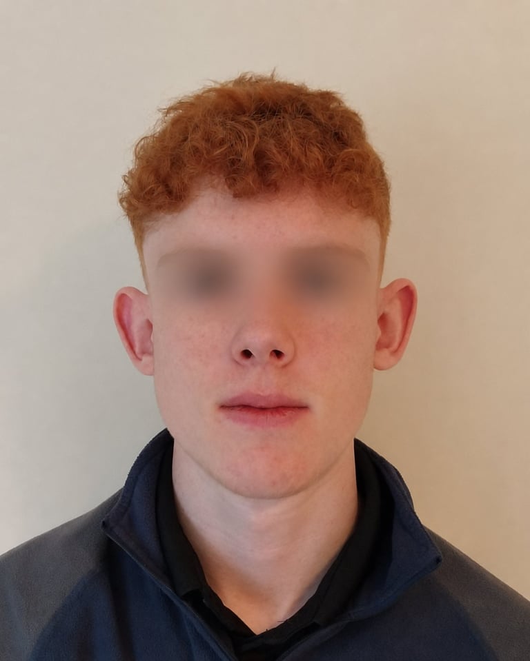 Person with reddish-brown curly hair, pixelated eyes, pale complexion wearing dark hoodie against neutral background